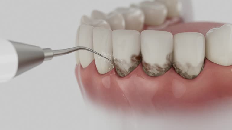 Reliable Tooth Extraction contractor in Platte City, MO by Smile Center Dentistry
